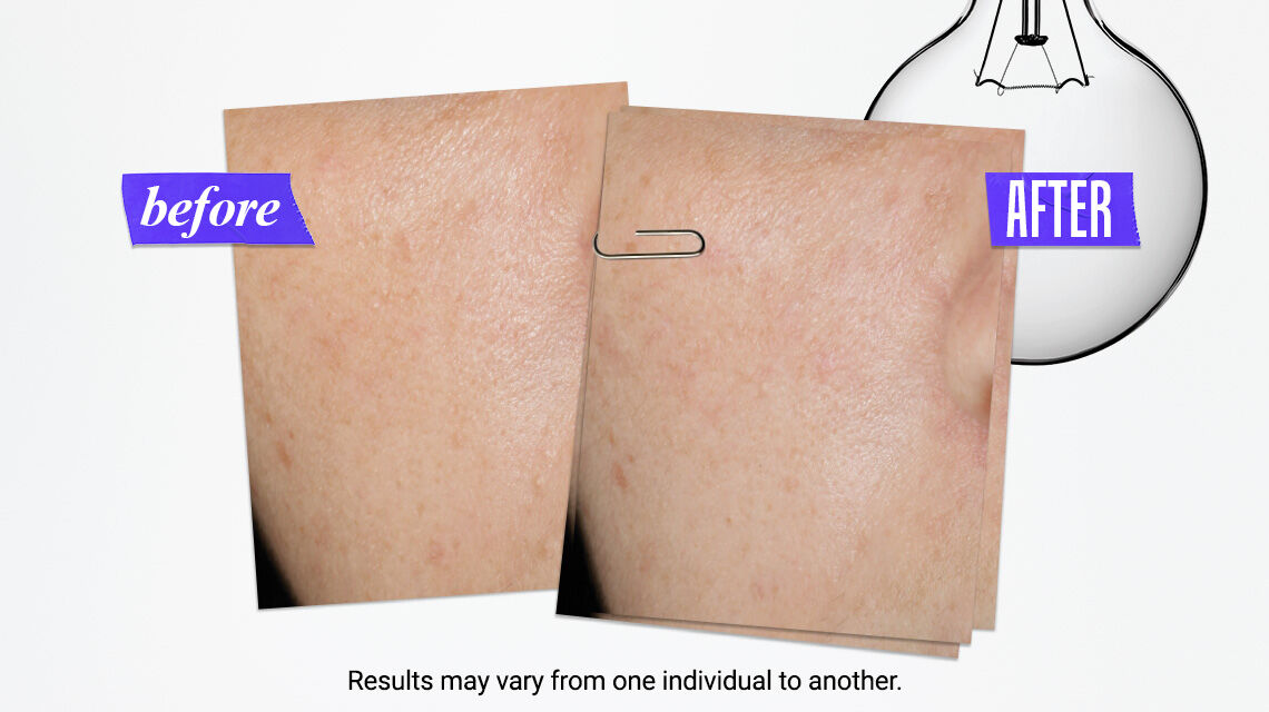 Clearly Corrective™ Dark Spot Solution | Dark Spot Serum | Kiehl's